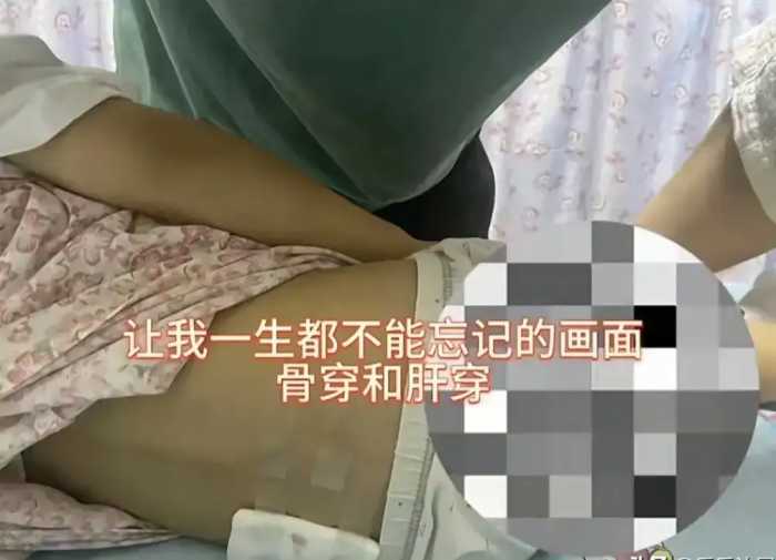 5岁抗癌宝宝毅玲去世，妈妈连葬礼都不参加，她为何不露面？